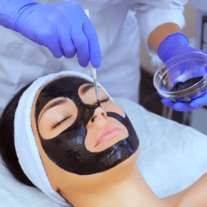 chemical peels and skin care