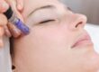 What does Micro-needling do for your face? How long does it take to heal from Micro-needling?