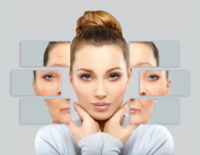 What is wrinkle fillers, and its advantages and disadvantages?