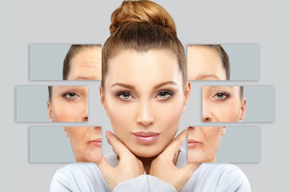 What is wrinkle fillers, and its advantages and disadvantages?