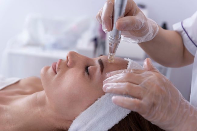 Microneedling by Alchemy West in Greenville SC