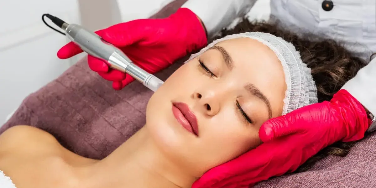 Microneedling by Alchemy West in Greenville, SC