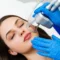 Laser Skin Resurfacing by Alchemy West in Greenville, SC