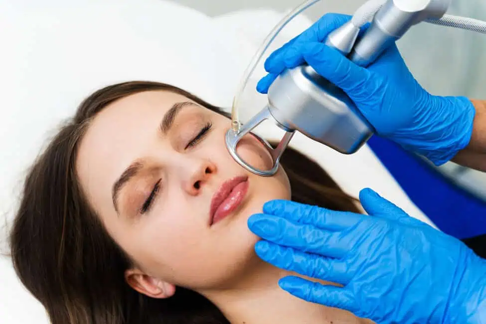 Laser Skin Resurfacing by Alchemy West in Greenville, SC