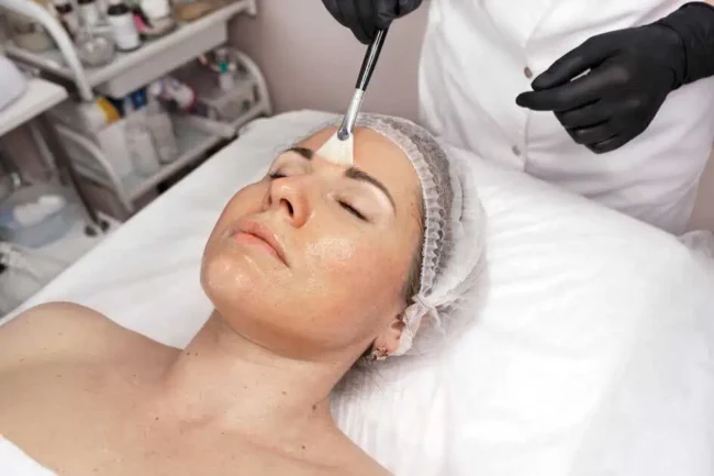 Chemical Peel Treatment in Greenville, SC by Alchemy West