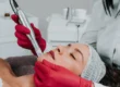 Woman receiving facial microneedling from a clinician in red gloves in Greenville, SC