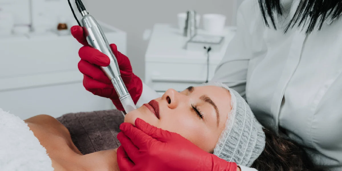 Woman receiving facial microneedling from a clinician in red gloves in Greenville, SC