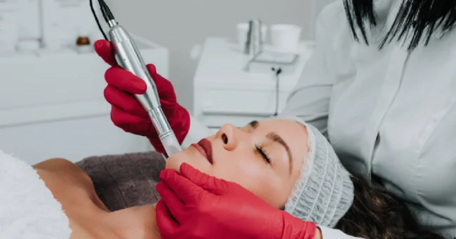 Woman receiving facial microneedling from a clinician in red gloves in Greenville, SC
