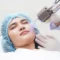 Laser skin resurfacing treatment on a woman’s face at a clinic in Greenville, SC